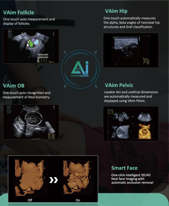 M&aacute;y si&ecirc;u &acirc;m 5D Vinno S100